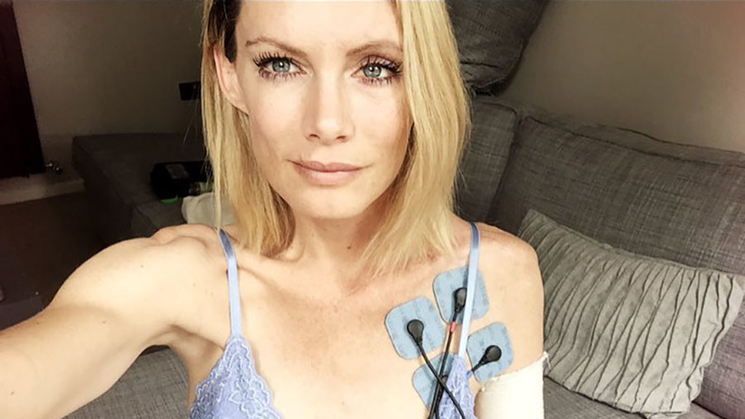 La doble de Milla Jovovich perdió un brazo durante el rodaje de 'Resident Evil: CapÃtulo final' y demanda a la producción