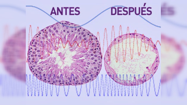Ondas de ultrasonido: contraceptivo masculino