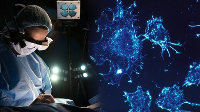 Inventan unas gafas que pueden 'ver' el cáncer