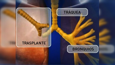 Operación única: Un respiro a todo pulmón