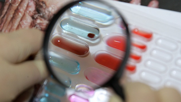 Desarrollan un nuevo método para hacer 30 análisis de sangre con una sola gota