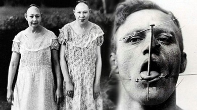 Escalofriantes retratos de los artistas de circo más extraordinarios de la historia