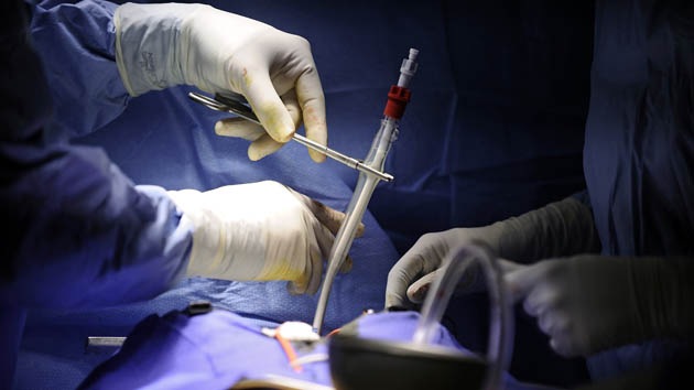 Bebé indio nacido con el corazón fuera del tórax deja estupefacto a los médicos