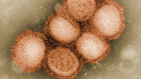 Las 'superbacterias' podrían matar a 10 millones de personas anualmente para 2050