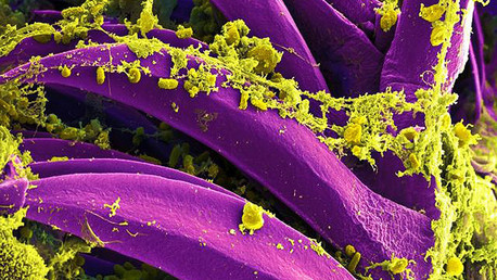 Los 3 virus mortales que casi acabaron con la humanidad