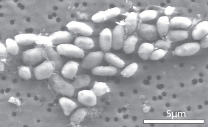 20 cosas que causan cáncer según la OMS