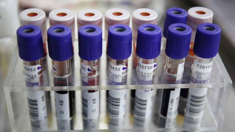 Una empresa de EE.UU. busca ganarle la carrera al cáncer con pruebas rápidas de ADN
