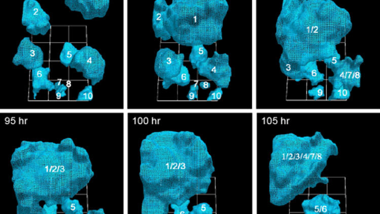 Video aterrador: Descubre cómo crece un tumor canceroso en 3D