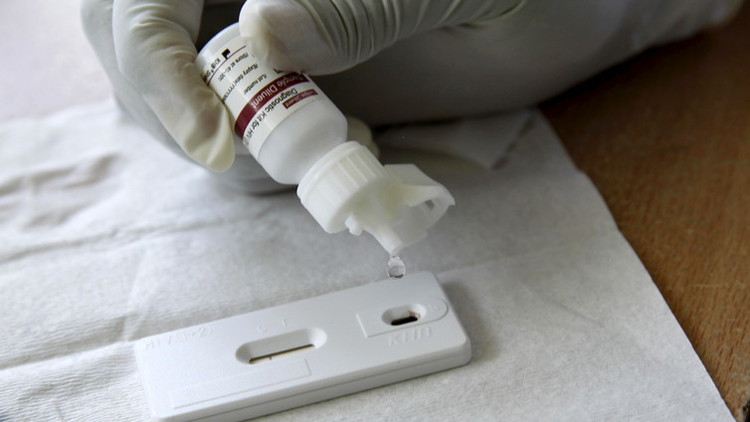 Hallan componente clave del VIH que podría desencadenar una revolución en el tratamiento del virus
