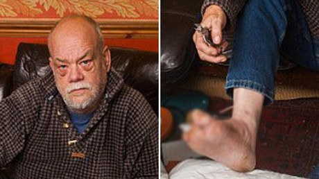 La increíble razón por la que un exsoldado se amputó dos dedos con unos alicates y sin anestesia