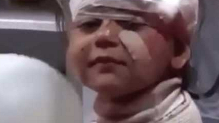 Desgarradoras imágenes: Niño herido sonríe a cámara tras atentado contra evacuados en Alepo (Video)