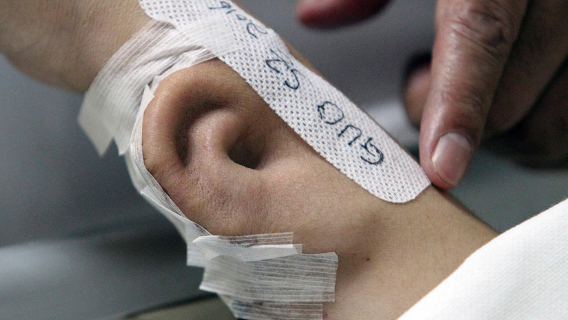 Una soldado de EE.UU. pierde la oreja pero la recupera en el brazo