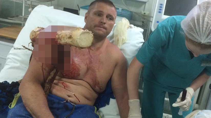 FUERTES IMÁGENES: Parapentista sufre un accidente y queda atravesado por el tronco de un árbol
