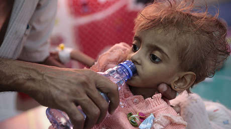 Un padre da agua a su hija desnutrida en un centro de alimentación de un hospital en Al Hudayda, Yemen, el 27 de septiembre de 2018.