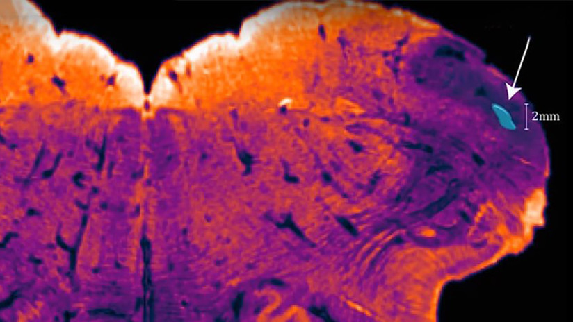 Descubren una región desconocida del cerebro humano