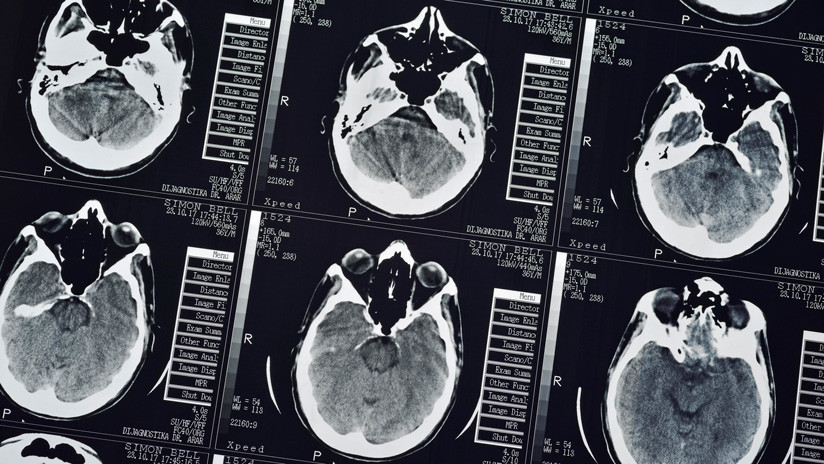 Demuestran que el cerebro humano produce nuevas neuronas hasta casi los 90 años