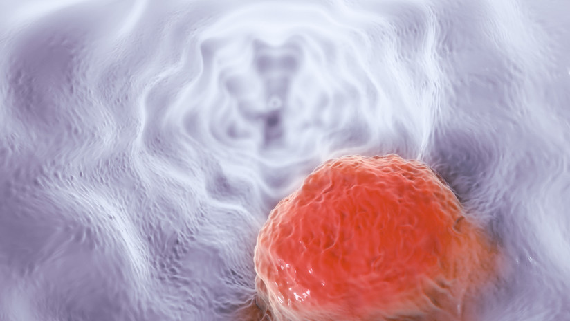 Descubren que una medicina ya en venta podría bloquear la propagación del cáncer Descubren que una medicina ya en venta podría bloquear la propagación del cáncer