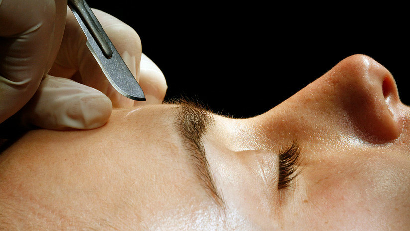 Una mujer fue por una rinoplastia y le amputaron parte de la nariz