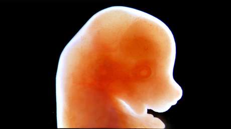Un embriÃ³n de ratÃ³n de 13 dÃ­as de edad