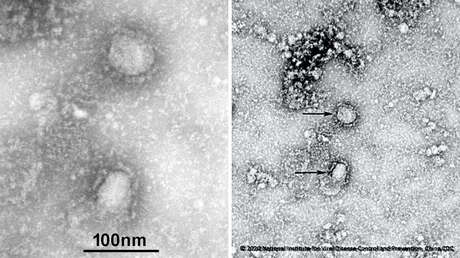 5e2aad1159bf5b1cdb1ac290 Publican primeras imágenes del mortal coronavirus originado en China