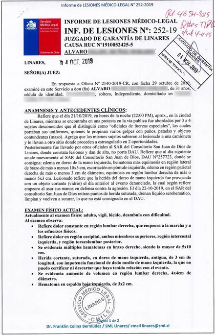 lo que causa moretones fáciles en el dorso de las manos lo que causa moretones fáciles en el dorso de las manos