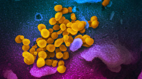 Nuevas imÃ¡genes en color muestran cÃ³mo es el coronavirus
