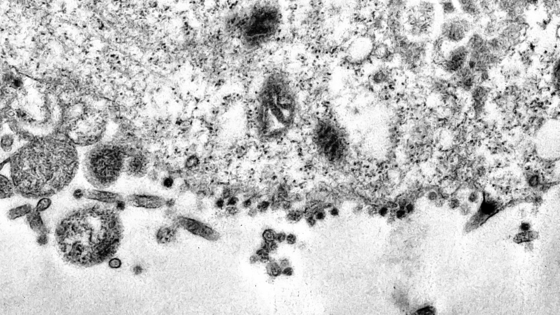 FOTOS: Científicos captan el momento en que el SARS-Cov-2 infecta una célula sana