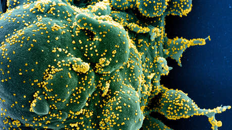 El covid-19 podría atacar las células del sistema inmunitario como el VIH