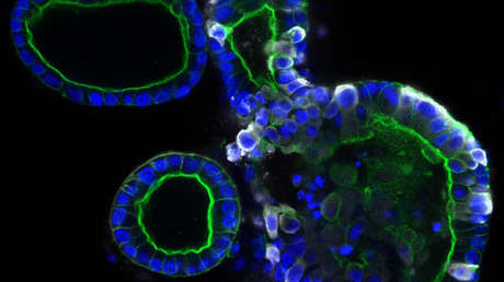 FOTOS: Así es cómo el coronavirus puede infectar y multiplicarse en el intestino