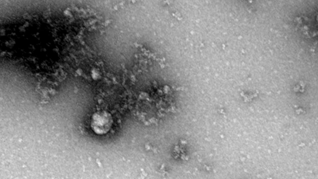 FOTO: Científicos rusos fotografían por primera vez la cepa británica del coronavirus