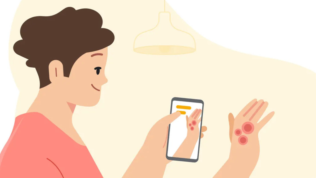 Google presenta una aplicación que ayuda al usuario a identificar afecciones de la piel con la cámara del móvil