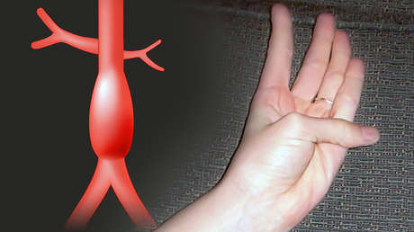Cómo saber si padecemos una condición cardiovascular grave moviendo un solo dedo