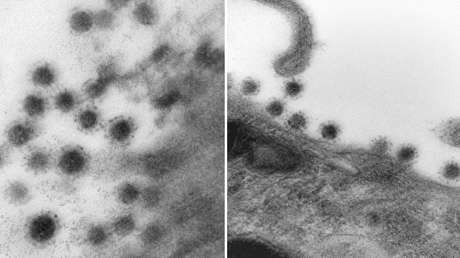FOTOS: Cómo se ve la cepa Delta del coronavirus a través de un microscopio