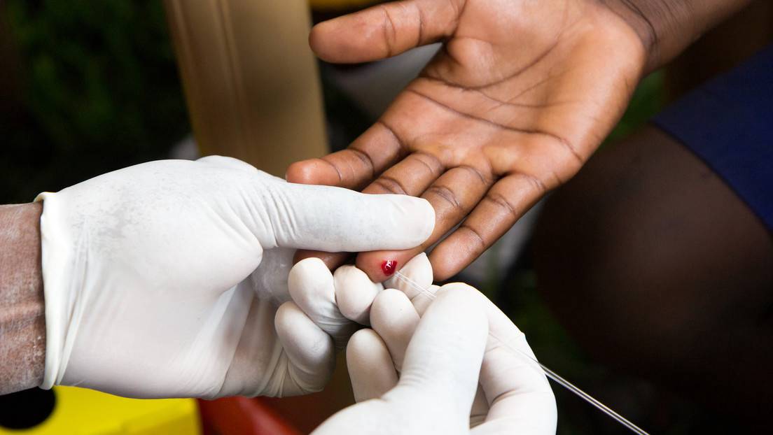 Una mujer se convierte en la segunda persona del mundo que se habría curado  de VIH por inmunidad natural