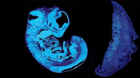 La primera «batalla de los sexos» comienza en el útero: los genes del padre y la madre del feto se pelean por comida, asegura un nuevo estudio