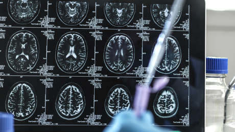 Un empleado de una autoridad médica canadiense afirma que el síndrome neurológico desconocido que afecta a los jóvenes «evoluciona muy rápido»