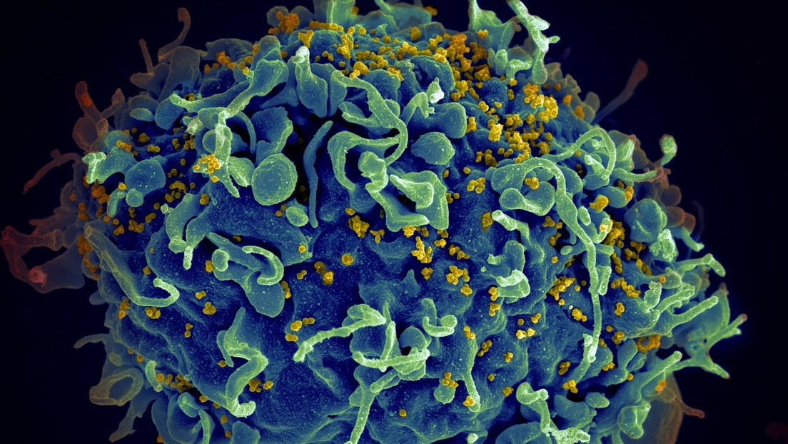 La primera mujer en curarse del VIH habría superado la enfermedad gracias a un trasplante de células madre tomadas de la sangre de un cordón umbilical