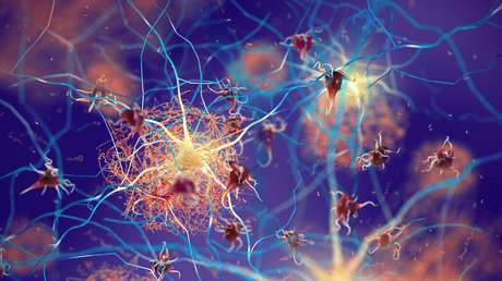 Científicos descubren una potencial terapia para reducir el daño cerebral en enfermos de Alzheimer o con trastornos relacionados