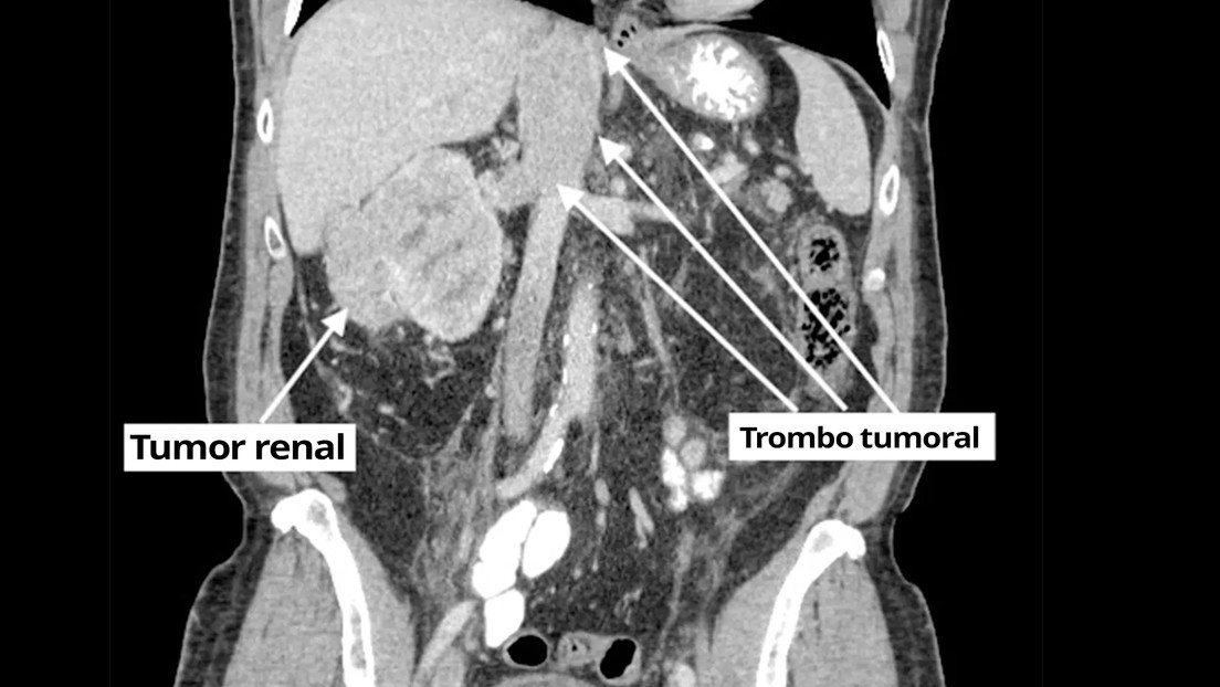 Va al médico por un dolor en el pie, le descubren que tenía cáncer y le advierten que le quedan cuatro días de vida