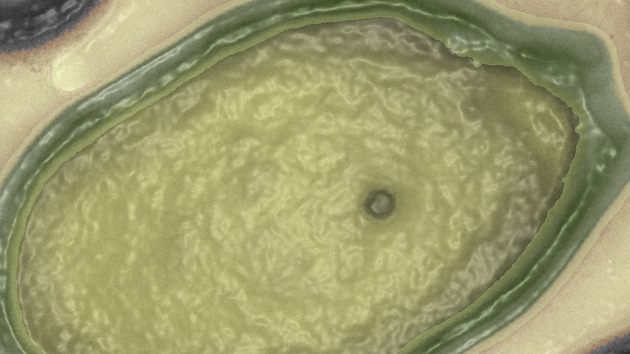 'Caza mayor' en el laboratorio: Descubren el virus más grande del mundo