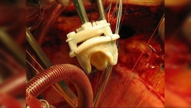 Buen corazón: tecnología médica de exportación