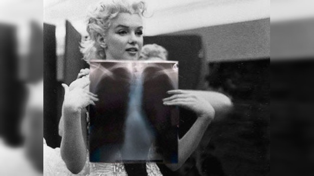 Venden radiografías de Marilyn Monroe en 45,000 dólares
