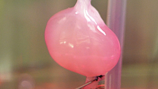 Crean un riñón artificial y lo trasplantan con éxito