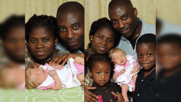 Niña rubia de ojos celestes de origen nigeriano
