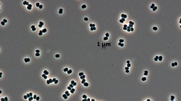Descubren un nuevo microorganismo superresistente en dos bases espaciales