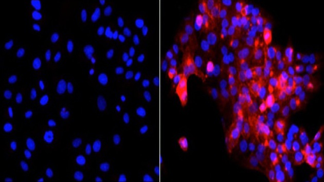 Un peligroso virus similar al SARS afecta a humanos y a animales