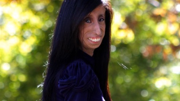 Lizzie Velasquez Pics