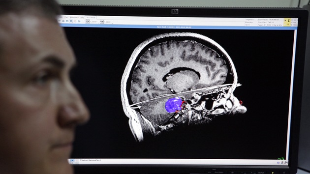 La orientación política: tendría que ver más con el cerebro que con el corazón