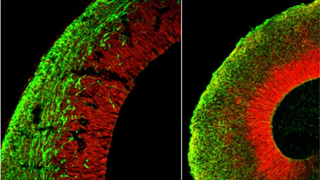 Nace el primer cerebro en laboratorio