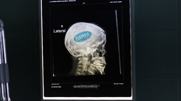 El Pentágono desarrolla implantes cerebrales para restaurar recuerdos